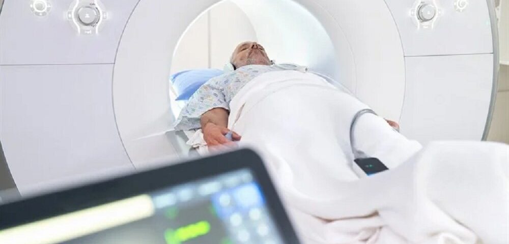 هوش مصنوعی با MRI کل بدن، عوامل دخیل در مرگ