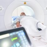 هوش مصنوعی با MRI کل بدن، عوامل دخیل در مرگ